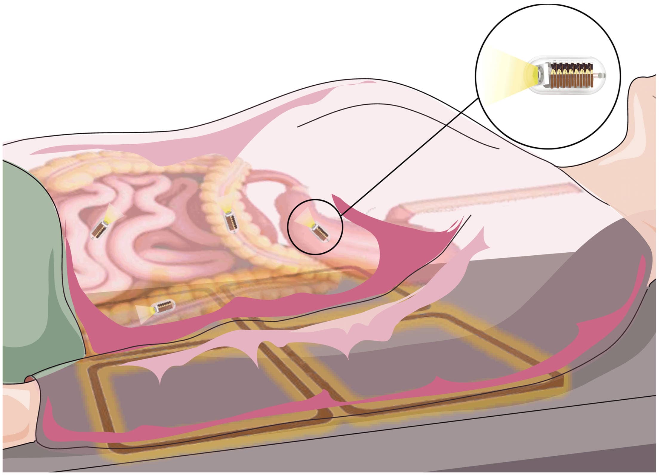 Wireless Capsule Robot Power - Thumbnail 2