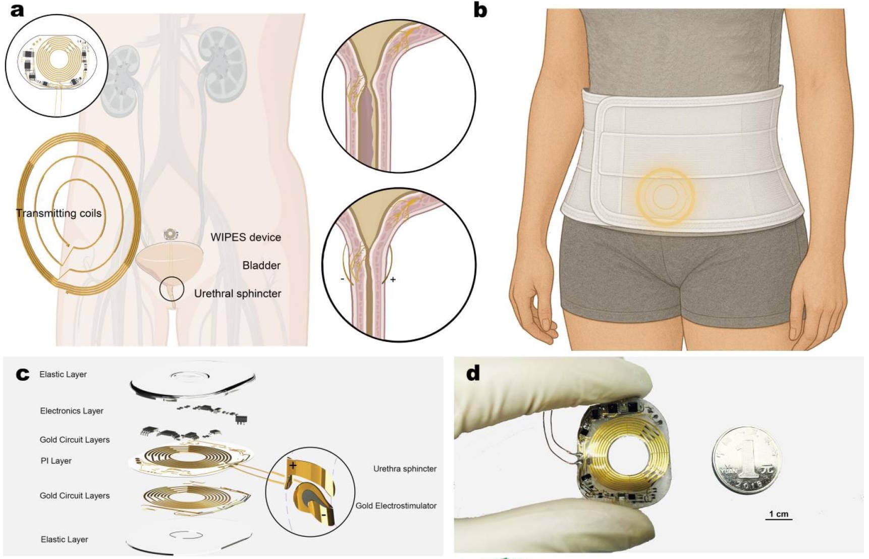 Wireless-Powered Neuromuscular Implant — image 1